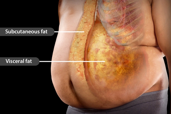 belly fat and insuline resistance