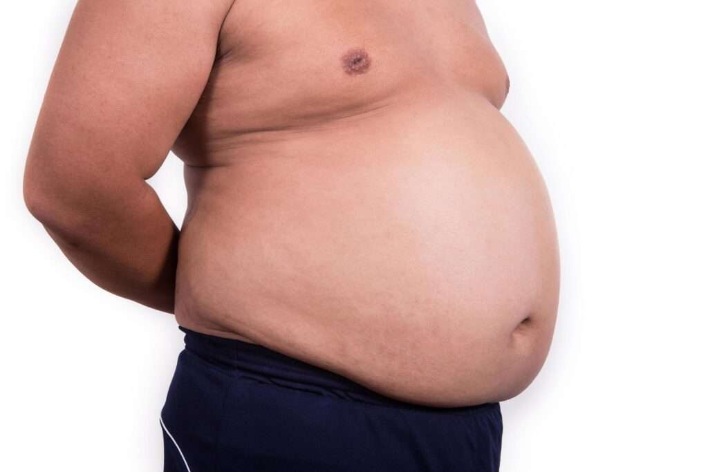 belly fat problem